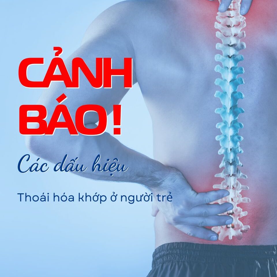 Dấu hiệu thoái hóa khớp ở người trẻ