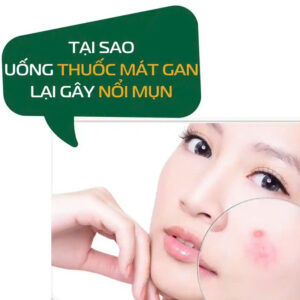 Tai Sao Uong Thuoc Mat Gan Lai Gay Noi Mun 01