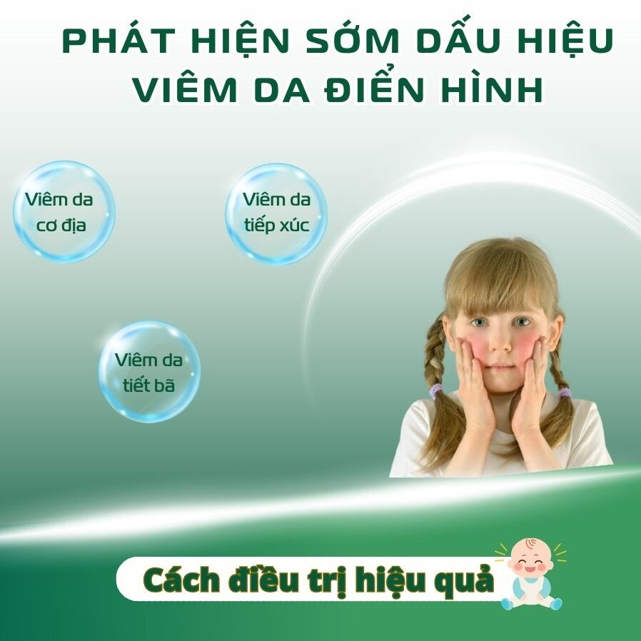 Dau Hieu Viem Da