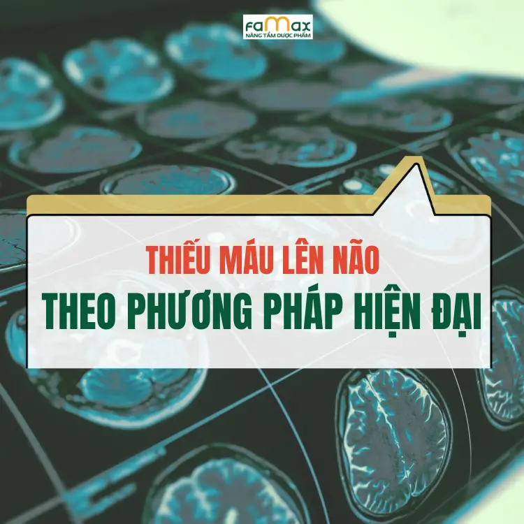 Thieu Mau Len Nao Nen Lam Gi Theo Phuong Phap Hien Dai 6808b93e4ed36.webp