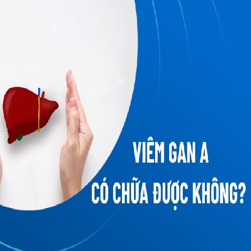 Viem Gan A Co Chua Duoc Khong Can Lam Ngay Dieu Nay Khi Bi Benh 67f9e2dbd6e6d