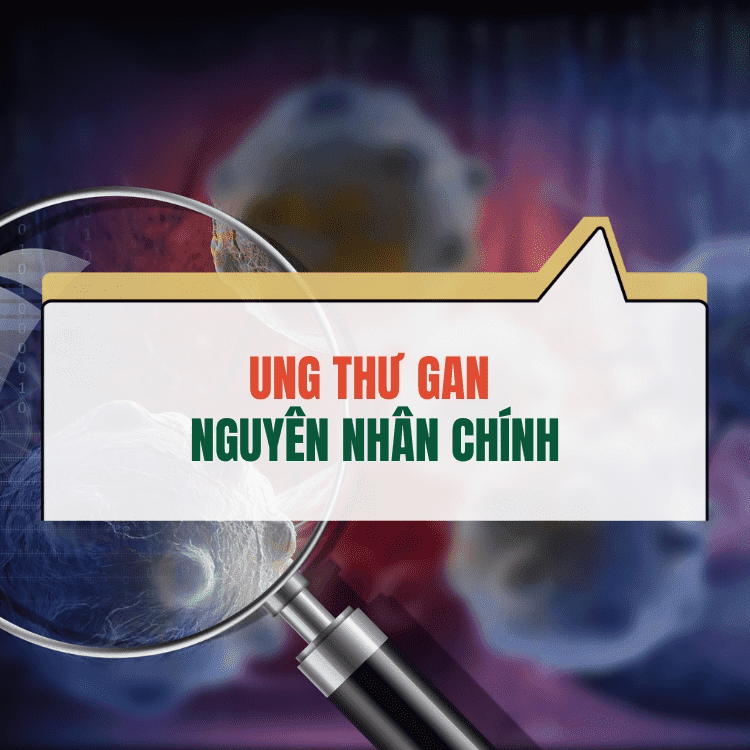 Nguyen Nhan Gay Ung Thu Gan Pho Bien Va Cach Phong Tranh