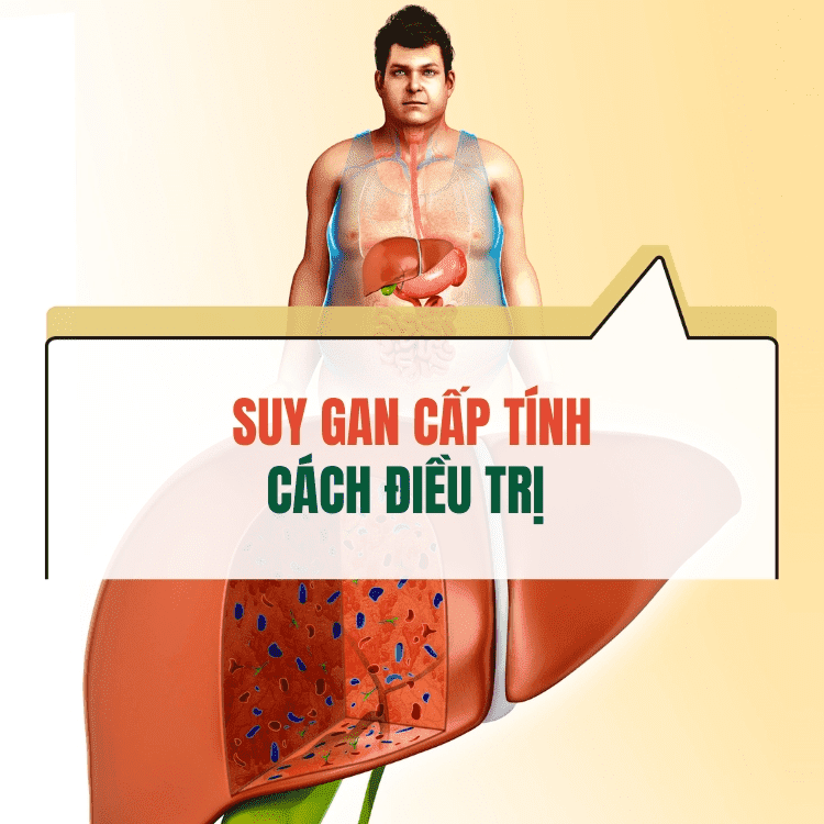 Suy Gan Cap Tinh Dieu Tri The Nao De Dat Hieu Qua Tot Nhat