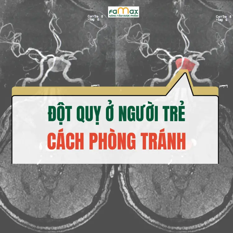 Trieu Chung Nhan Biet Dot Quy Vo Mach Mau Nao 6814872faf957.webp