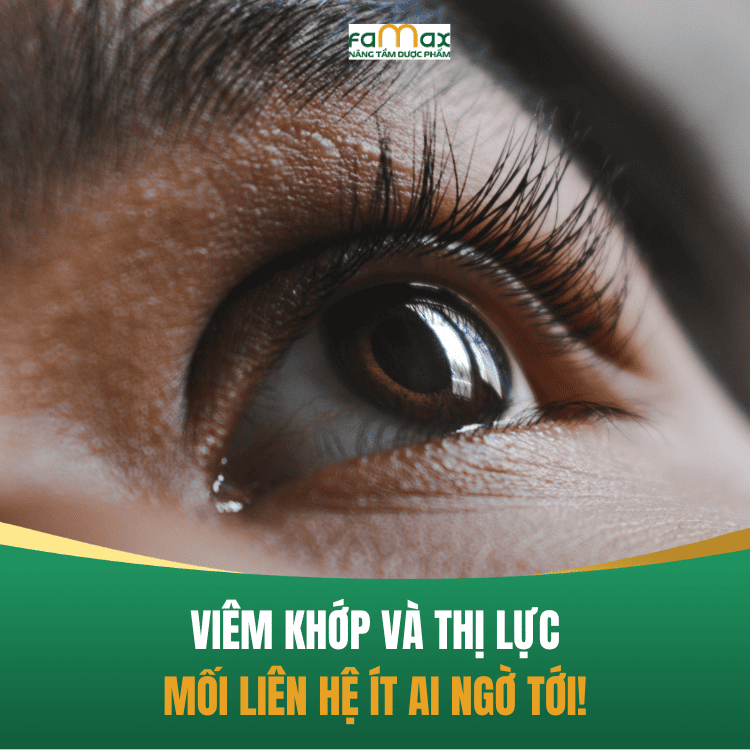 Viem Khop Dang Thap Anh Huong Den Thi Luc