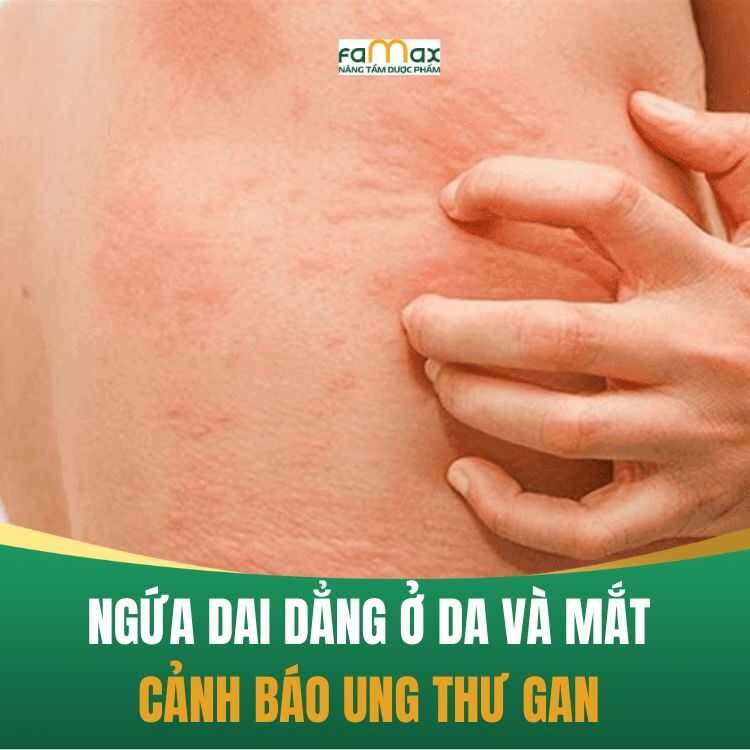 Ung Thu Gan