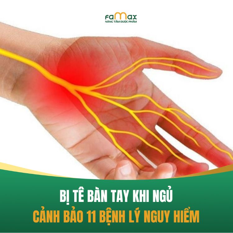 Bi Te Ban Tay Khi Ngu La Benh Gi