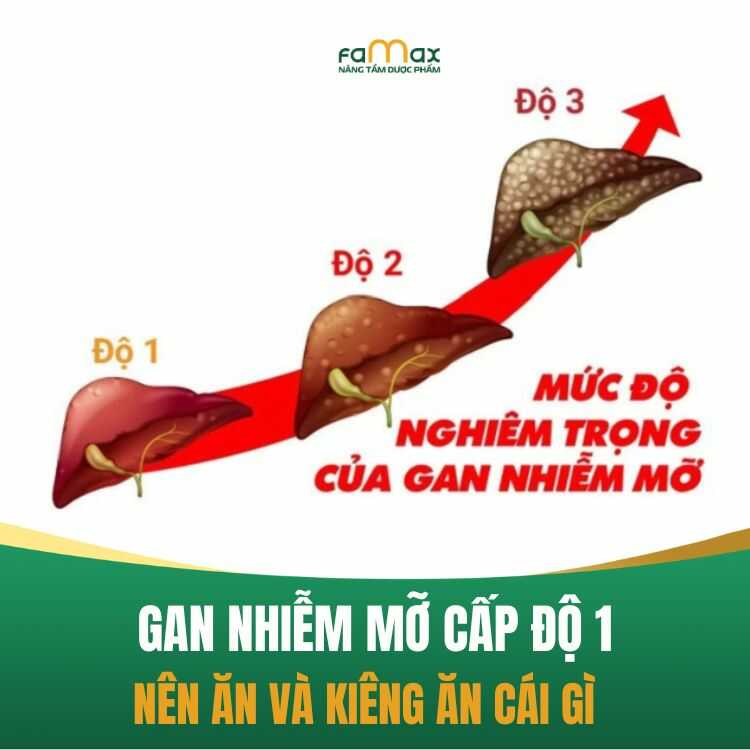 Gan Nhiem Mo Do 1 Nguyen Nhan Trieu Chung Va Cach Dieu Tri Hieu Qua 68aed7caa24d2.webp