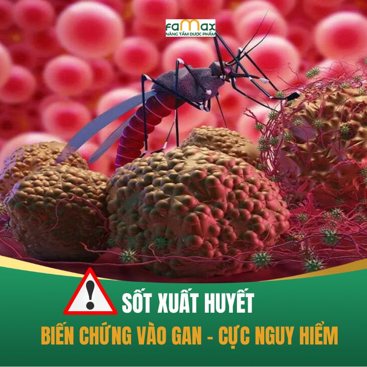 Gan Nhiem Mo Nen An Gi