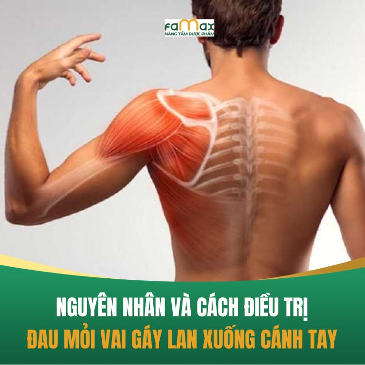 Nguyen Nhan Va Cach Dieu Tri Dau Moi Vai Gay Lan Xuong Canh Tay (1)