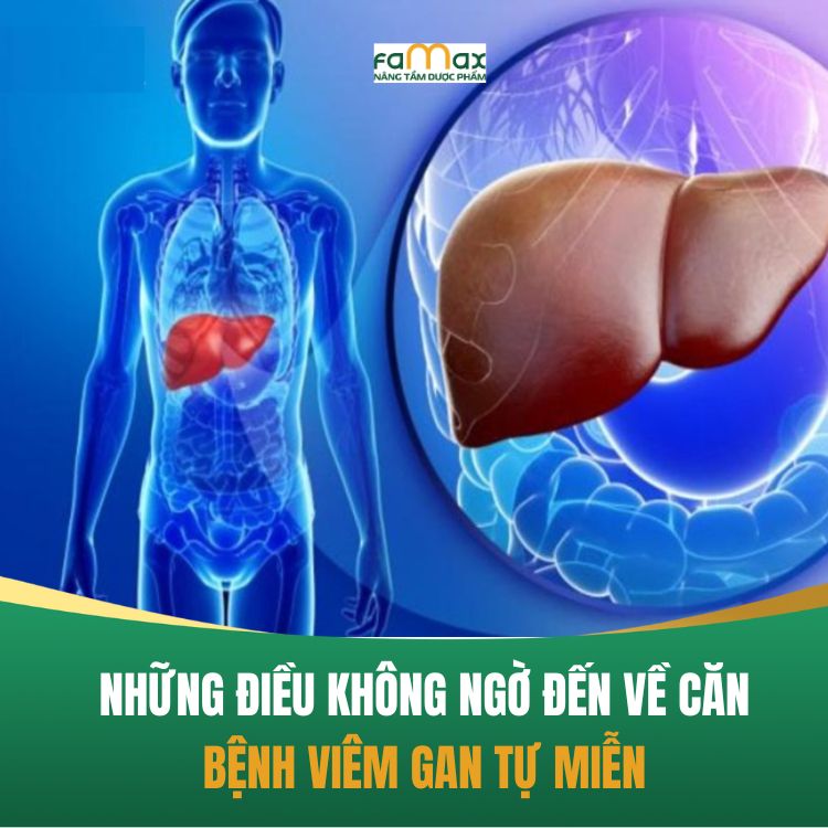 Nhung Dieu Khong Ngo Den Ve Can Benh Viem Gan Tu Mien 68c28750a2424.webp