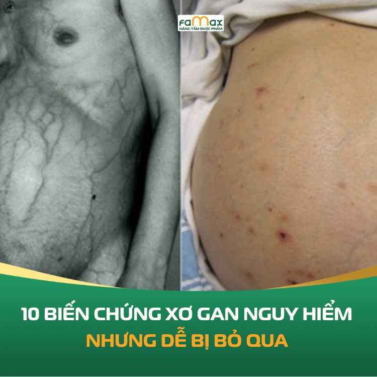 10 Bien Chung Xo Gan Nguy Hiem Nhung De Bi Bo Qua 6904384bd1e7e.webp