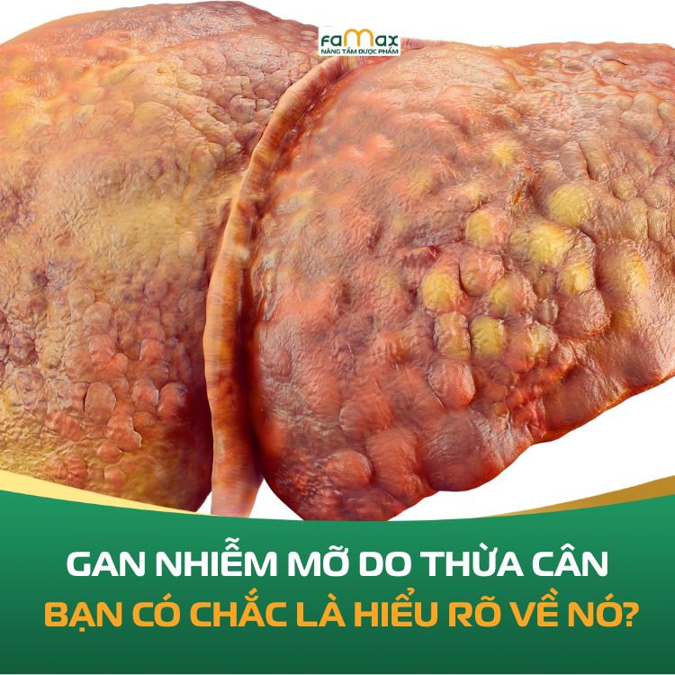 Gan Nhiem Mo Do Thua Can Ban Co Chac La Hieu Ro Ve No 69155e917b840.webp