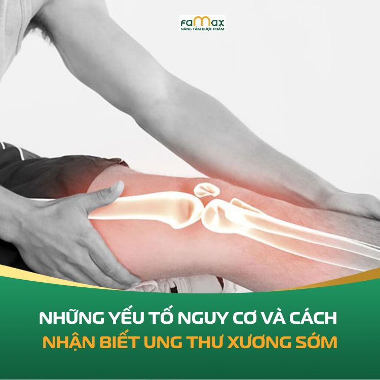 Nhung Yeu To Nguy Co Va Cach Nhan Biet Ung Thu Xuong Som 690c4ba66a739.webp